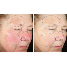 Load image into Gallery viewer, SkinBetter Science Even Intensive Skin Tone Correcting Serum
