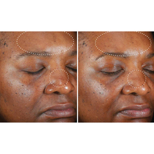 Load image into Gallery viewer, SkinBetter Science Even Intensive Skin Tone Correcting Serum

