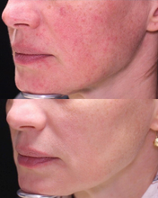 Load image into Gallery viewer, IPL - Buy 3, Get 1 FREE
