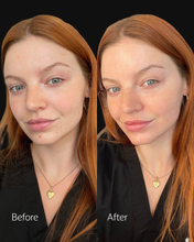 Load image into Gallery viewer, 25% OFF Microneedling Package
