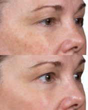 Load image into Gallery viewer, Clear + Brilliant - Buy 3 Get 1 FREE
