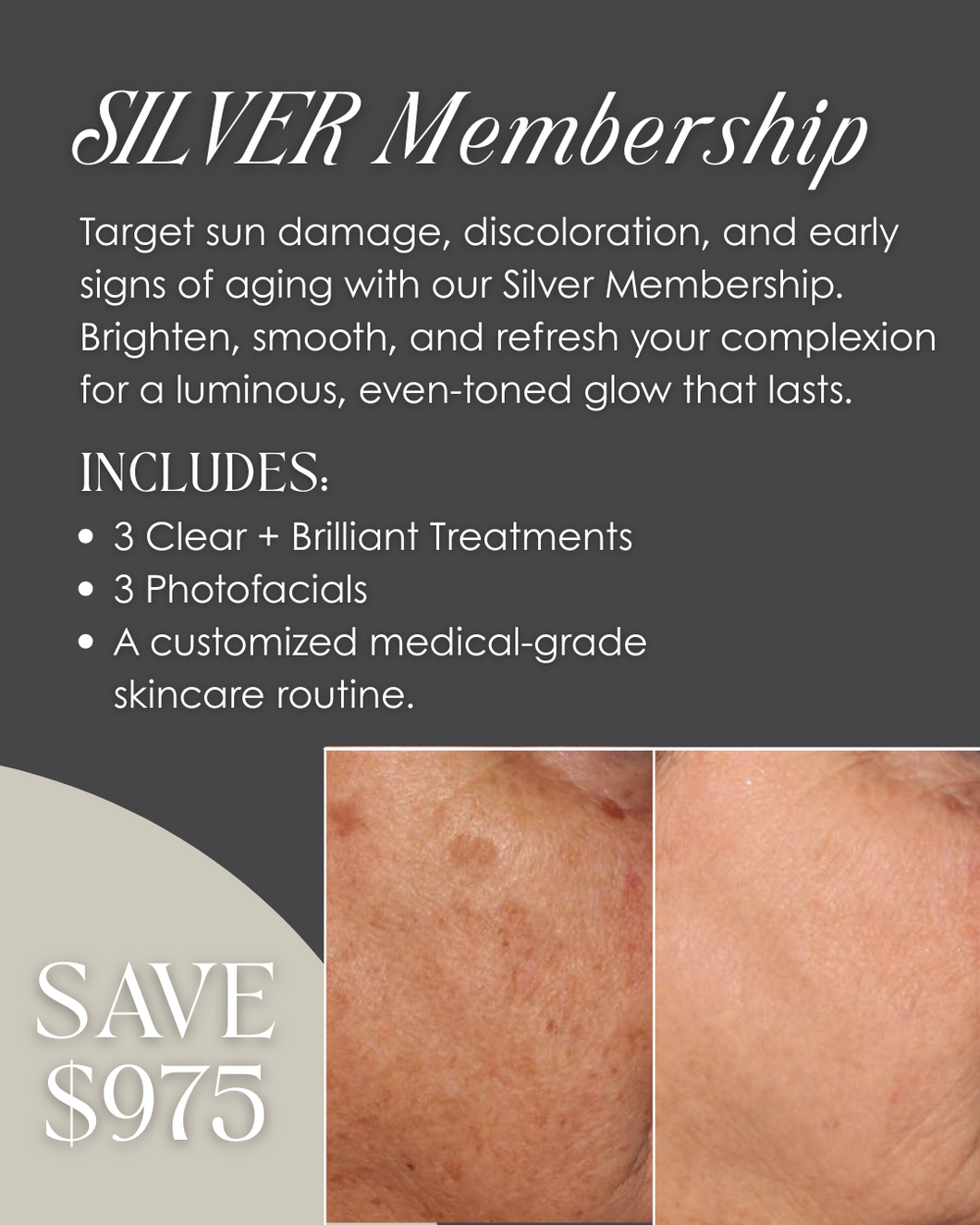 Silver Membership