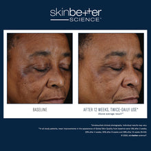 Load image into Gallery viewer, SkinBetter Science Mystro Active Balance Serum
